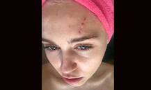 बिल्ली ने किया माइली को लहूलुहान!