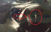 प्रेग्नेंट महिला के अल्ट्रासाउंड में दिखें 'ईसा मसीह', डॉक्टर्स हैरान और लोग परेशान!