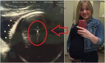 प्रेग्नेंट महिला के अल्ट्रासाउंड में दिखें 'ईसा मसीह', डॉक्टर्स हैरान और लोग परेशान!