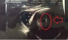 Ultrasound Decision: मरीज को अल्ट्रासाउंड घर ले जाने की हाईकोर्ट ने दी मंजूरी, अस्पताल ले जाने पर बिगड़ी थी तबीयत