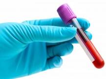 ब्राजील में जीका के मामलों में गिरावट : WHO