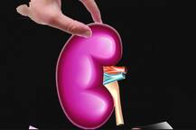 Health Tips: अपनी किडनी को रखना चाहते हैं स्वस्थ तो डाइट में शामिल करें ये 5 चीजें
