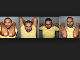 21 Days Of Yoga Exercises For Cervical Pain DAY 3- अंतर्राष्ट्रीय योग दिवस: फ्रोजन शोल्डर की समस्या दूर करेगा स्कंध संचालन आसन