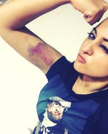 सोनाक्षी सिन्हा को फिल्म की तैयारी के दौरान लगी गंभीर चोट!