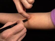 टीबी संक्रमण के नए तरीके की पहचान हुई