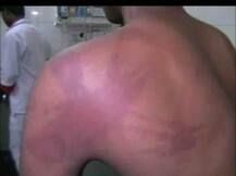 मज़दूरी मांगने पर फैक्ट्री के मालिक ने मजदूर को बेरहमी से पीटा, करंट भी लगाया