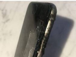 iPhone6 के कारण बुरी तरह जला पैर, अस्पताल में चल रहा इलाज!