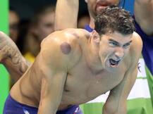 फेलप्स के कंधे पर ये क्या था ?