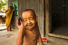 बचपन में बूढ़ा बनाने वाली रहस्यमयी बीमारी से पीड़ित है चार साल का बायेजीद