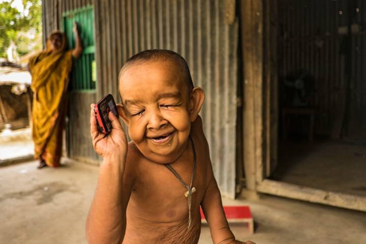 ढाका के एक बड़े हॉस्पिटल के डॉक्टर एक गरीब किसान परिवार से आने वाले बायेजीद सिकदर की हालत देखने के बाद उसकी बीमारी की पहचान करने और उसका इलाज फ्री में करने के लिए राजी हो गये है.