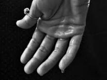 OMG! अपने ही पसीने से एलर्जी है इस औरत को