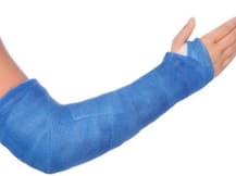 टूटी हड्डी की जल्दी रिकवरी चाहिए तो अपनाएं ये कुदरती नुस्खा!