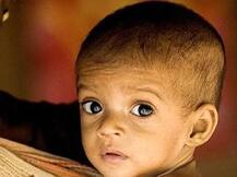 बिहार में कुपोषित बच्चों की संख्या सर्वाधिक