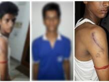 बेरहम टीचर ने की बेकसूर छात्र की बर्बरता से पिटाई, दी FIR ना करने की धमकी!