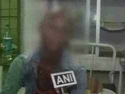 दबंगों की बेरहमी: नाबालिग को पहले पीटा, फिर गंजाकर सीने पर लिखा चोर