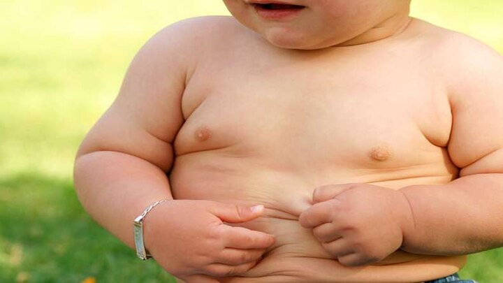 Preventing Obesity In Children बच्चों का मोटापा नहीं रोका तो हो सकती हैं ये समस्याएं!