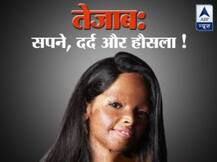 पहली कड़ी: तेज़ाब ने जिंदगी जला दी, हिम्मत नहीं जला सका जालिम