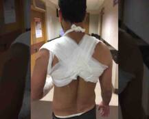 चोटों और हाथ में पट्टी बांध सामने आया पीड़ित, सलमान के शेरा पर आरोप!