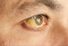 विंटर्स में मूली खाएंगे तो होंगे ये फायदे! 