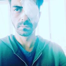 अर्जुन रामपाल की आंख में चोट लगी