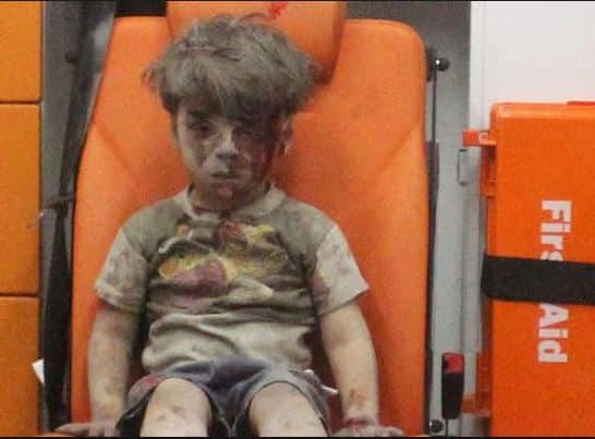 हाल में सीरिया में हुए एक हमले के बाद चार साल के ओमरान की दहशत से भरी हुई तस्वीर सामने आई थीं.