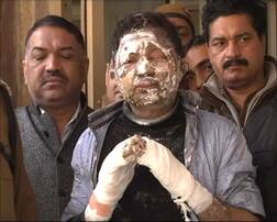 सनक: दो मिनट में पिता को मारे 36 चाकू, बोला- अगर मां होती तो उसे भी मार देता