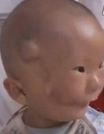 सोशल मीडिया पर वापस से Huikang की तस्वीरें आने के बाद एक बात जो सबके जेहन में है कि अब उसकी हालत कैसी है क्योंकि इस मामले में चीनी मीडिया में भी कोई तात्कालिक रिपोर्ट नहीं है. वहीं ऑपरेशन के बाद से ही मीडिया में बच्चे को लेकर कोई खास रिपोर्टिंग नहीं हुई है.