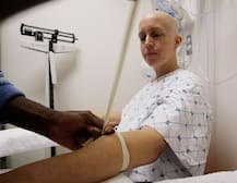 कीमोथेरपी करवाने वालों के लिए खुशखबरी! अब नहीं गिरेंगे बाल