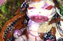 हैरतअंगेज! गर्भावस्था में इन छोटी-छोटी कमियों के कारण नहीं हो पाता भ्रूण का विकास