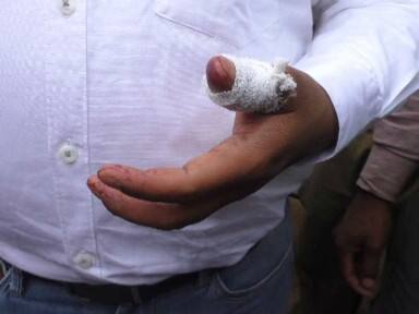 यूपी चुनाव: अपना दल नेताओं से मारपीट के बाद BJP ने सोरांव सीट पर बिठाया अपना उम्मीदवार