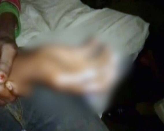 एमपी: बेटे का मोबाइल खोने पर 5 दोस्तों के हाथ गर्म तेल में डलवाए, पिता गिरफ्तार