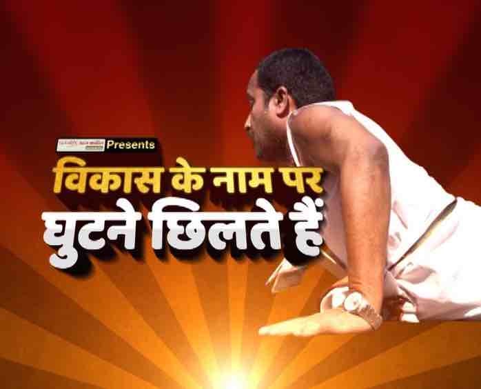 वोट के नाम पर जुमले चलते हैं विकास के नाम पर घुटने छिलते हैं Bihar Mla Reaches Assembly With Bruised Knees In Shorts वोट के नाम पर जुमले चलते हैं विकास के नाम पर घुटने छिलते हैं