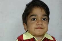 इस बच्चे को इलाज के लिए चाहिए सालाना पौने दो करोड़, सरकार भी मददगार नहीं