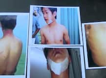 बेंगलुरु: क्राइस्ट यूनिवर्सिटी के नॉर्थ ईस्ट छात्र को मकान मालिक ने बेरहमी से पीटा, जूते भी चटवाए!