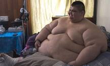 दुर्लभ अनुवांशिक गड़बड़ी के चलते है इमान अहमद का मोटापा