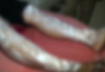 यूपी: संभल में पत्नी पर तेजाब से हमला, आरोपी पति गिरफ्त से बाहर