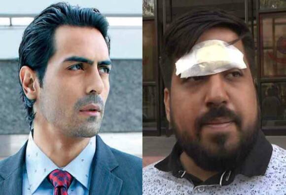 अर्जुन रामपाल पर लगा मारपीट का आरोप, जानें एक्टर ने इसपर क्या कहा है?