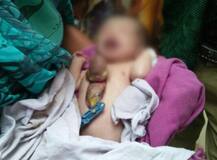 OMG! बच्ची का धड़कता दिल दिखता है साफ