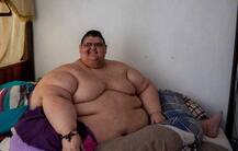 दुनिया के सबसे मोटे व्यक्ति की मेक्सिको में हुई सर्जरी!