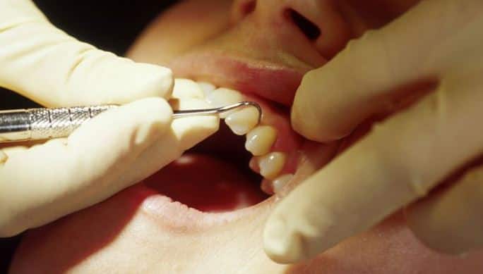 Risk %e2%80%8bfrequent Recreational Use Of Marijuana May Increase Gum Disease Risk गांजे का सेवन बढ़ा सकता है मसूड़ों के रोग को