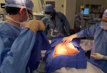 मोटापा कम करने के लिए की जाती है बैरिएट्रिक सर्जरी!