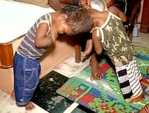 सिर से जुड़े जुड़वा बच्चों को अलग करने की कोशिश करेंगे एम्स के डॉक्टर