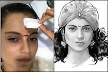 \'मणिकर्णिका\' के सेट पर तलवारबाजी के दौरान घायल हुई कंगना रनौत, माथे पर लगे 15 टांके