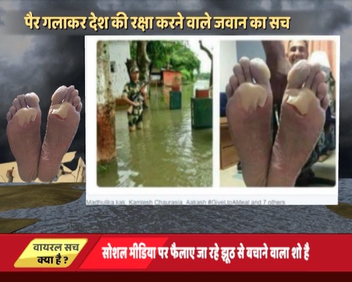 पैर गलाकर देश की रक्षा करने वाले जवान का सच