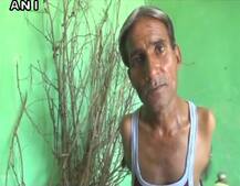 बिना हाथ के जन्मे मोहनलाल ने पैरों को हथियार बनाकर सिखाया जीने का जज़्बा