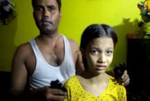 नहीं सुलझा चोटी काटने का रहस्य: 5 राज्यों में 100 मामलों के बाद लोगों में डर