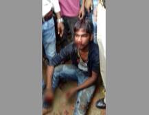 यूपी: लखीमपुर में दिल दहला देने वाली घटना, सिरफिरे ने बीच सड़क पर काटा लड़की का हाथ