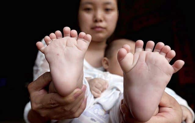 900000 Chinese Babies Born With Birth Defects Annually चीन में हर साल विकार के साथ पैदा होते हैं 9 लाख बच्चे