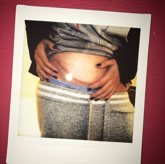 सेलेना ने ये भी बताया है कि Lupus को लेकर बहुत सारी गलत जानकारियों फैली हुई हैं और उन्होंने www.lupusresearch.org नाम की एक वेबसाइट पर जाकर लोगों से इसके बारे में और जानकारी लेने को कहा है. 