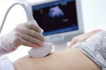 आईवीएफ तकनीक की विफलता के ये कारण जानते हैं आप